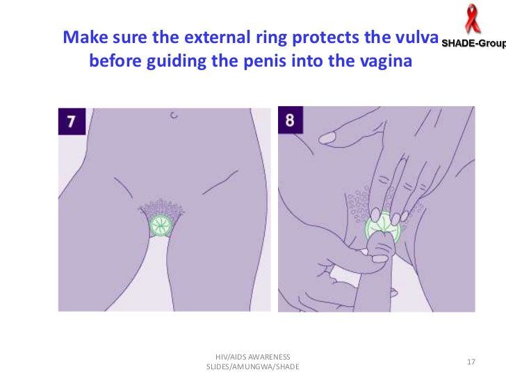 Inserting penis into vagina